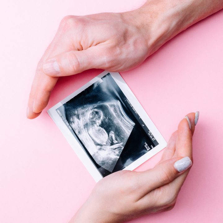 Ultrasound picture pregnant baby photo. Woman hands holding ultrasound pregnancy image on pink background. Concept of pregnancy, maternity, expectation for baby birth